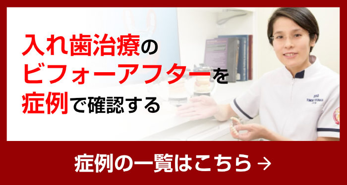 入れ歯治療のビフォーアフターを、症例で確認する